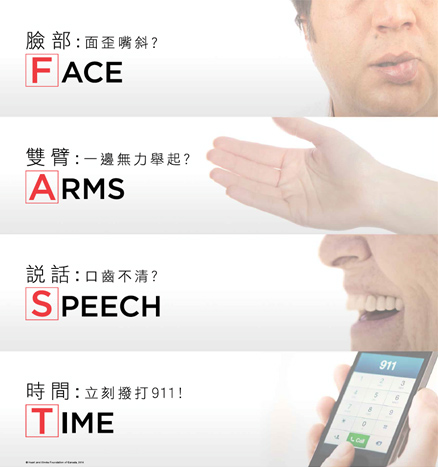 Face, Arms, Speech, Time