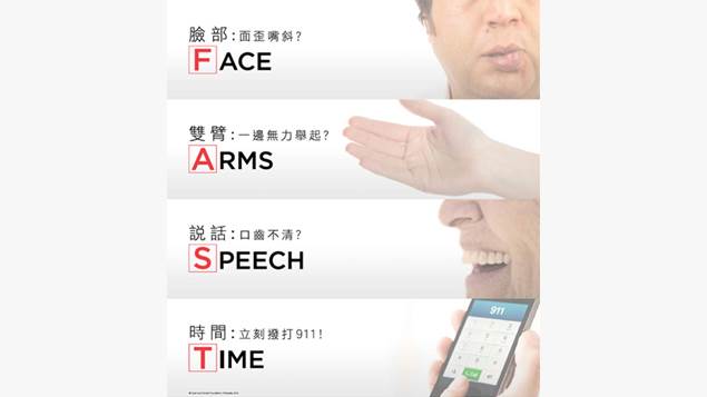 Face, Arms, Speech, Time