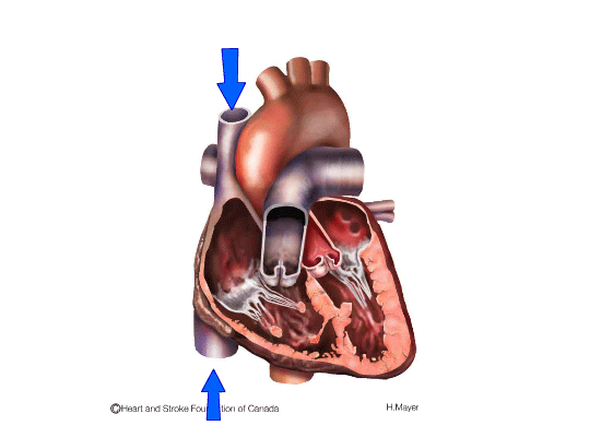 A cross-section of the heart with arrows showing the heart movement of blood through the heart.