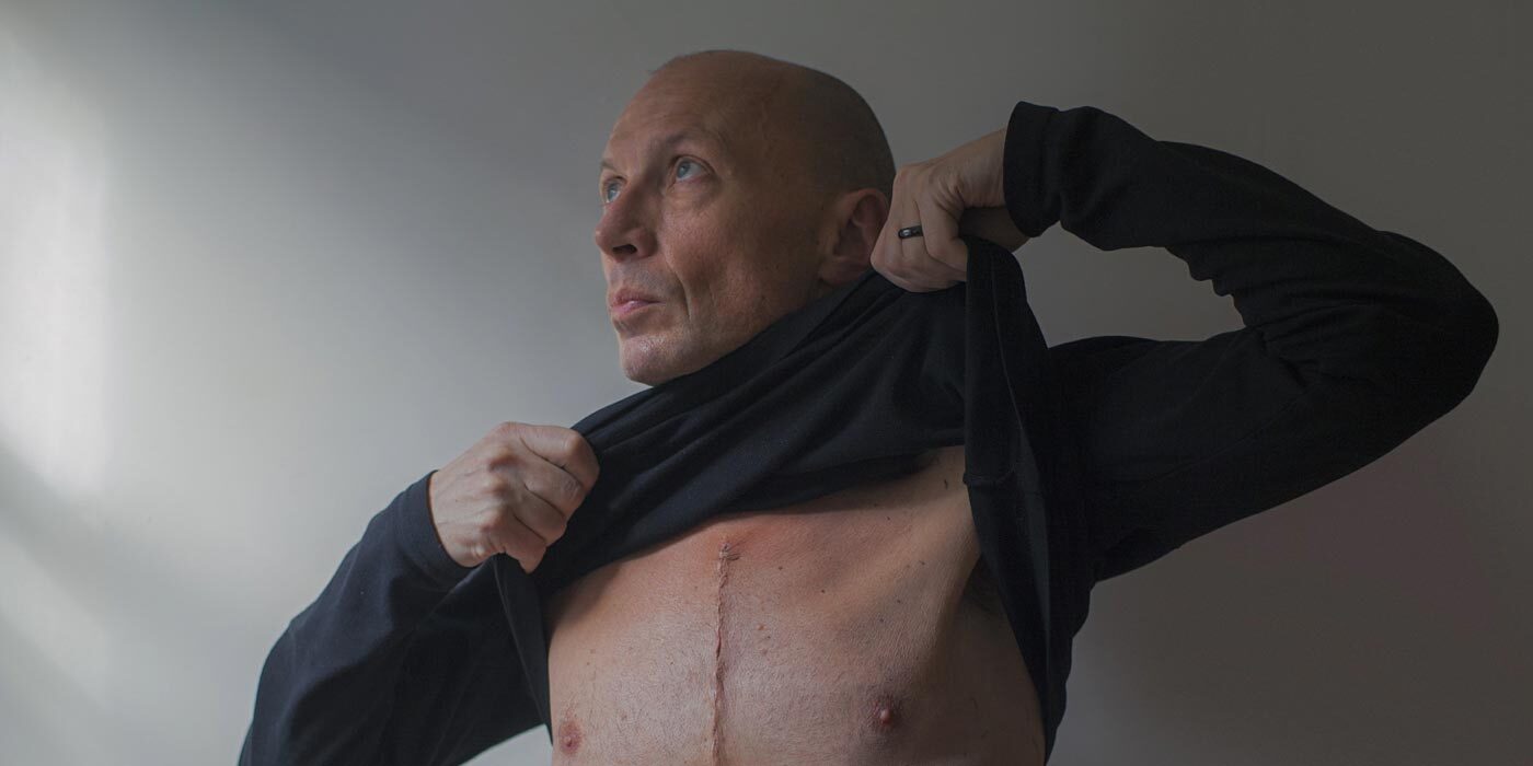 man with surgical scar
