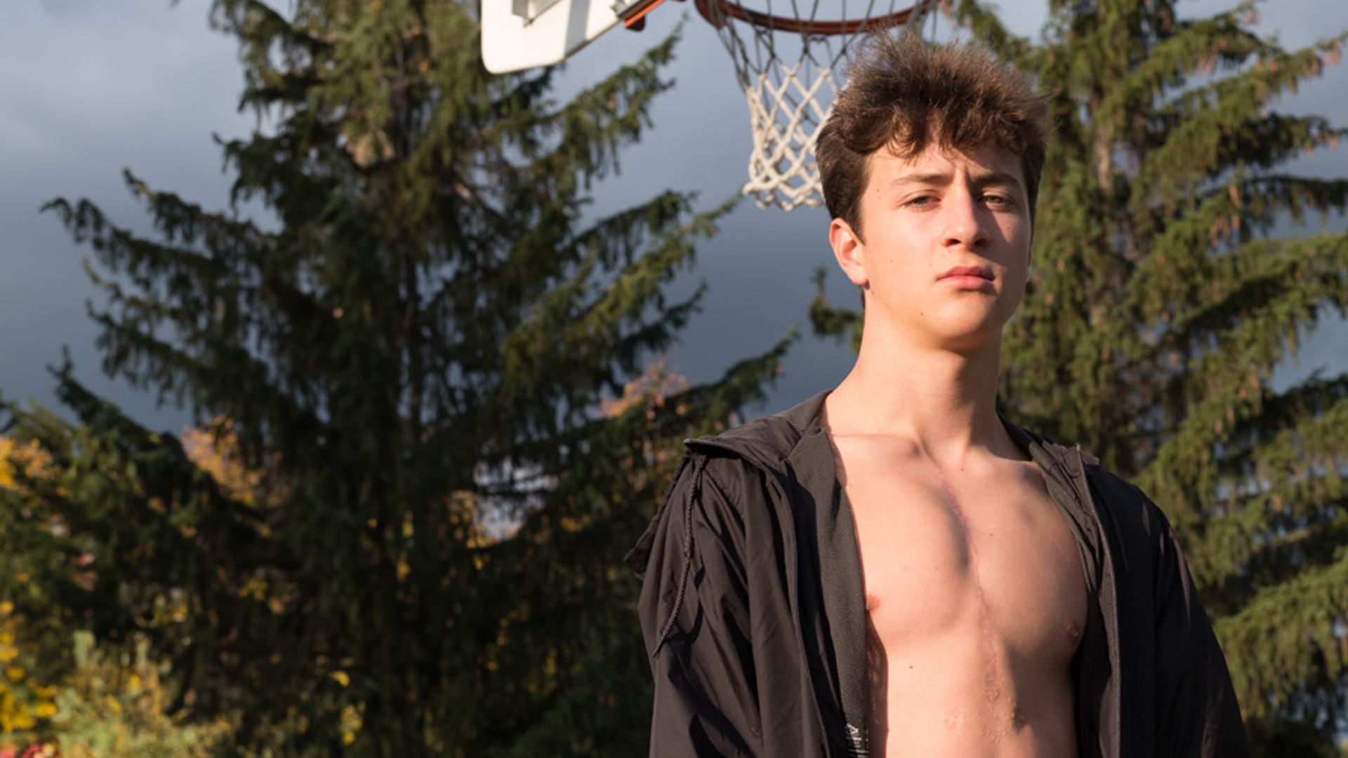 Olivier Lanthier shows the scar from his heart transplant