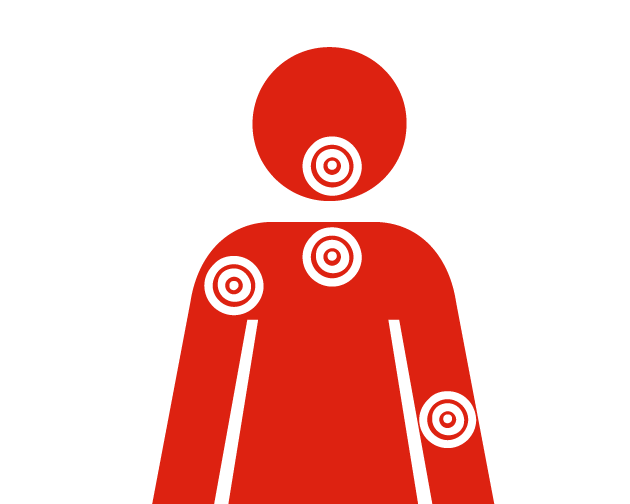 Upper body discomfort Upper body discomfort