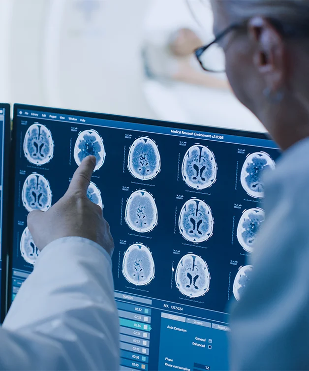 Doctors studying brain scans
