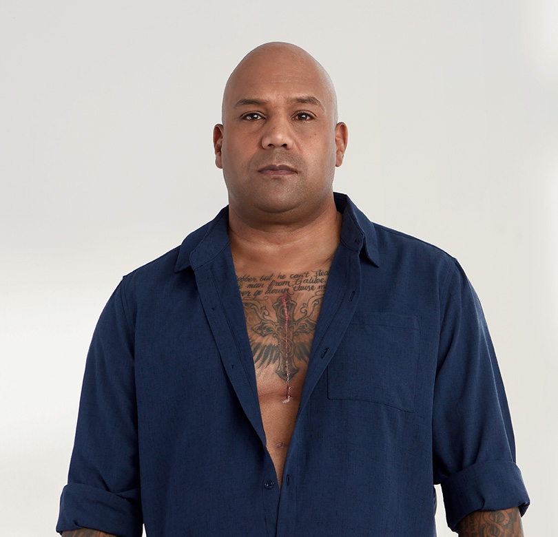 Heart disease survivor, Kevin Lobo, exposes a scar on his chest