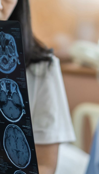 A doctor holds up a sheet of brain scans and is explaining them to her patient