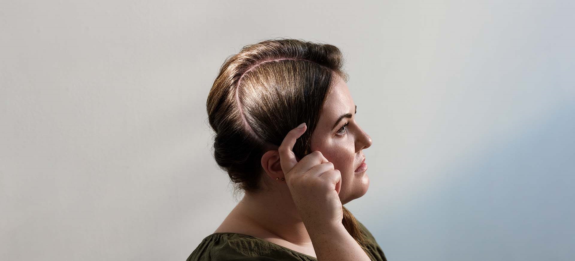 Courtney Chartrand, living with stroke
