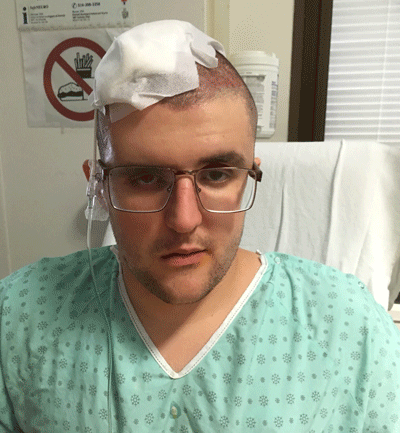 Justin’s first brain surgery took 13 hours.