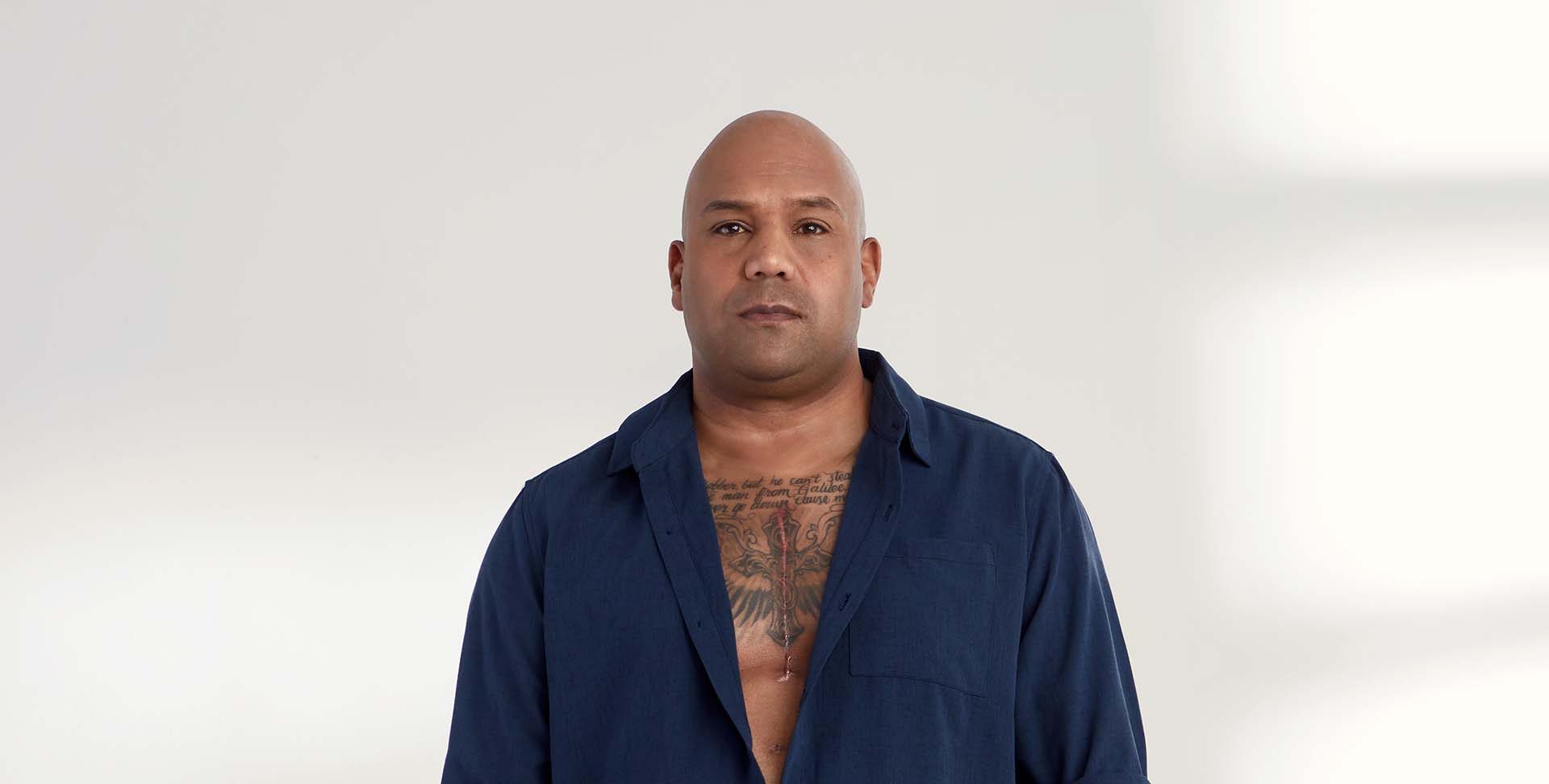 Heart disease survivor, Kevin Lobo, shows his chest scar through his button-down shirt