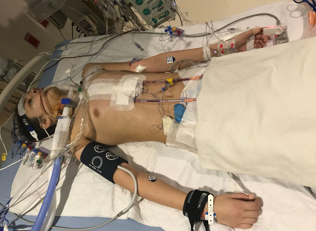 Olivier Lanthier lies unconscious in a hospital bed with tubes and wires connected to his face and chest.