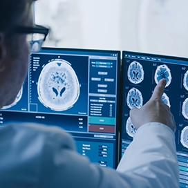 Researchers studying brain scans.
